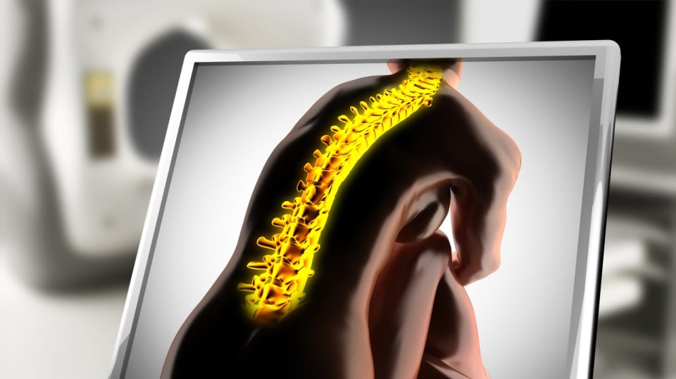 Úrazové pojištění a osteoporóza